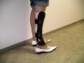 Vybavení ortoprotézou pro ortopedické postižení v obl.bérce a zkrat končetiny cca 10cm